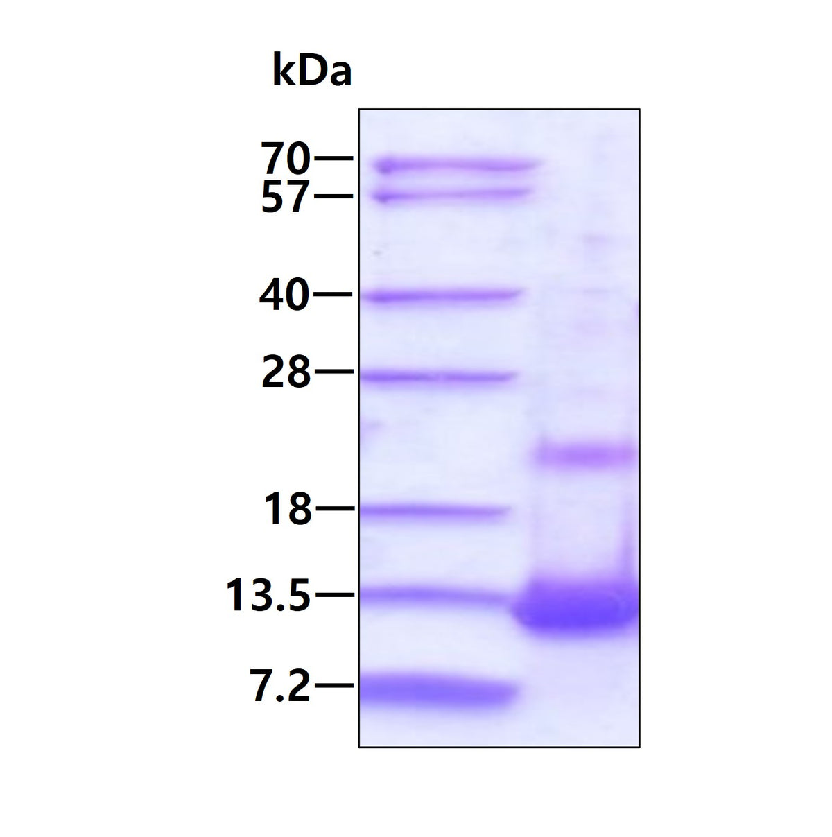 CXCL4 Human, His - Product image 1
