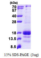 CXCL9 Human, His - Product image 1