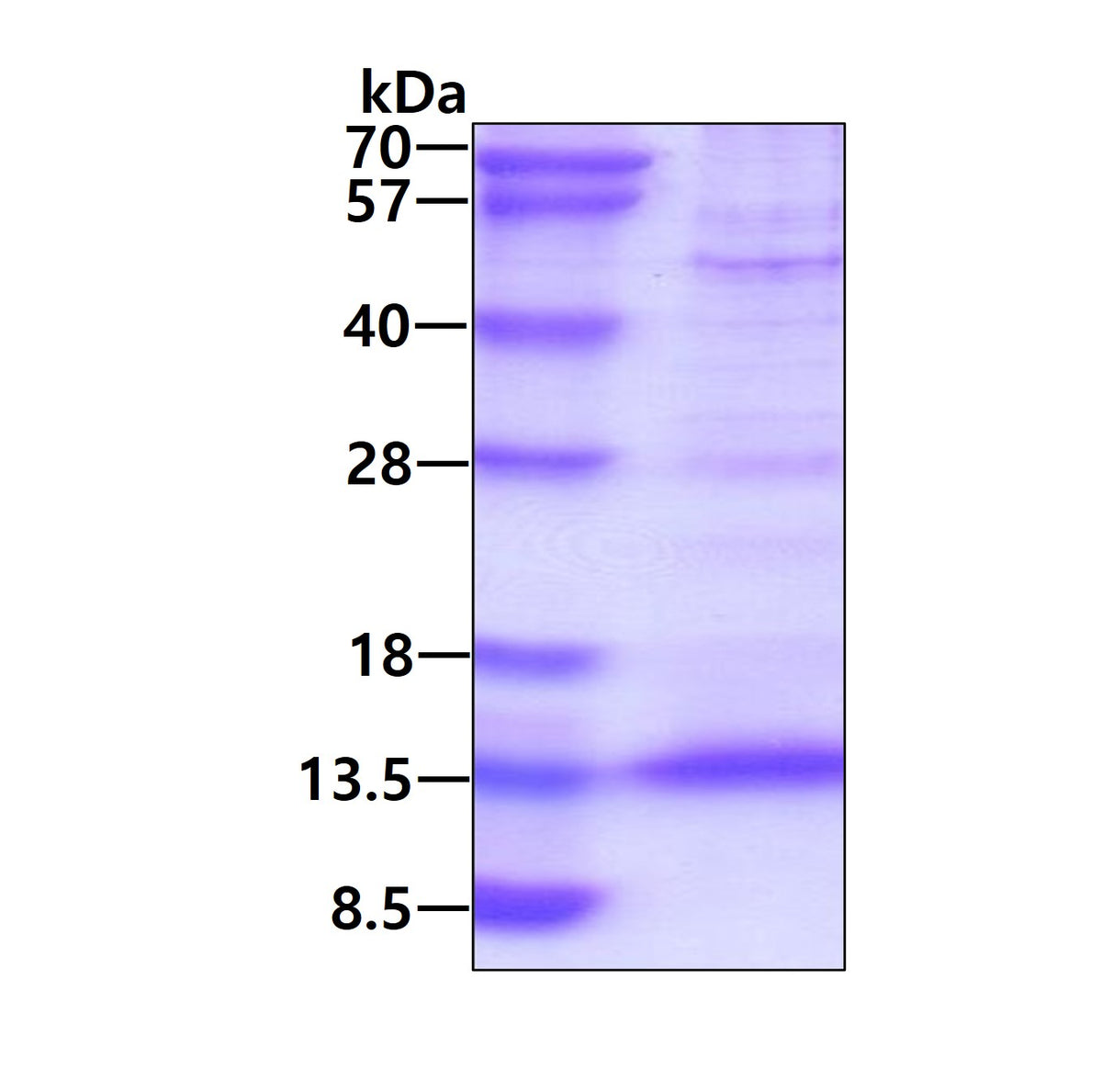 CXCL4 V1 Human - Product image 1