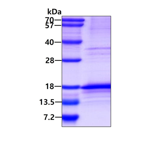 CCL25 Human, His - Product image 1