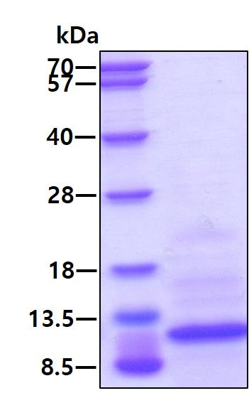 CCL20 Human, His - Product image 1