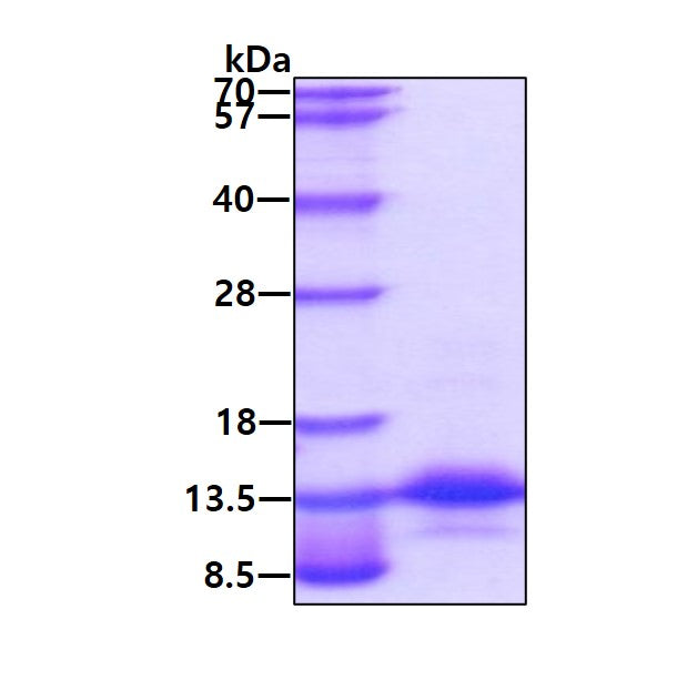 MIP 1a Human, His - Product image 1