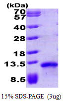 CCL17 Human, His - Product image 1