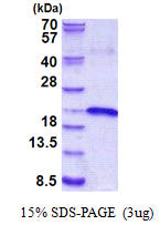 IL17B Human, His - Product image 1