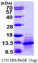 CCL1 Human, His-SDS-PAGE - Product image 1