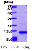 CCL26 Human-SDS-PAGE - Product image 1