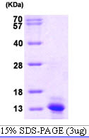 CCL2 Human, His-SDS-PAGE - Product image 1