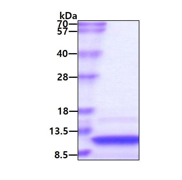 CTACK Human-SDS-PAGE - Product image 1