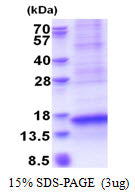 CXCL17 Human, His-SDS-PAGE - Product image 1