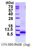 CXCL1 Mouse, His-SDS-PAGE - Product image 1