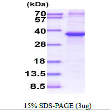 IGFBP3 Human, His - Product image 1