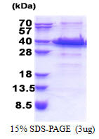 IGFBP7 Human - Product image 1