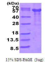 IL12RB1 Human - Product image 1