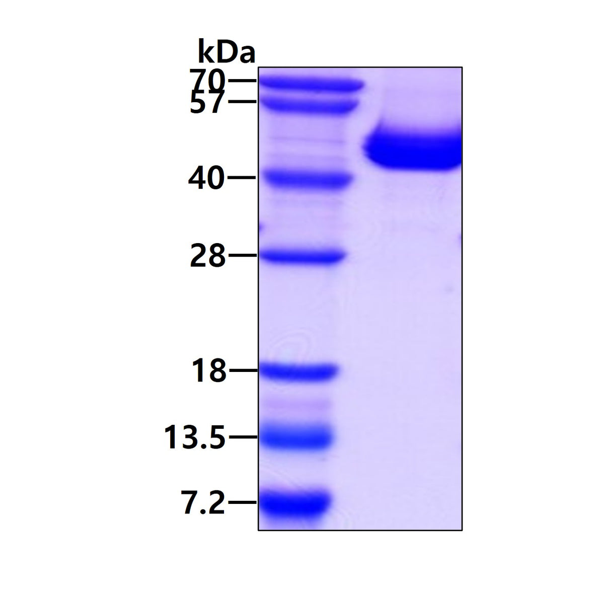 IL12p40 Human Baculovirus - Product image 1