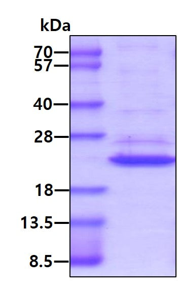 IL1B Mouse, His Active - Product image 1