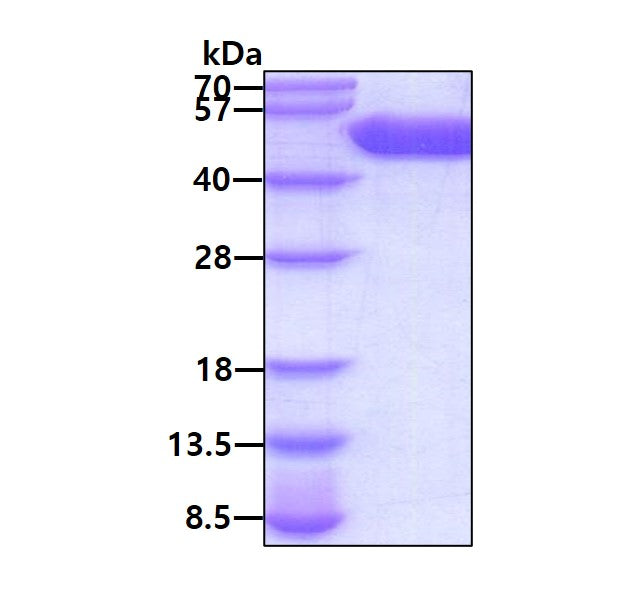 IL1R1 Human - Product image 1