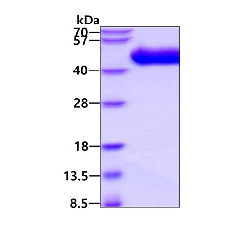 IL1RL1 Human, Sf9 - Product image 1