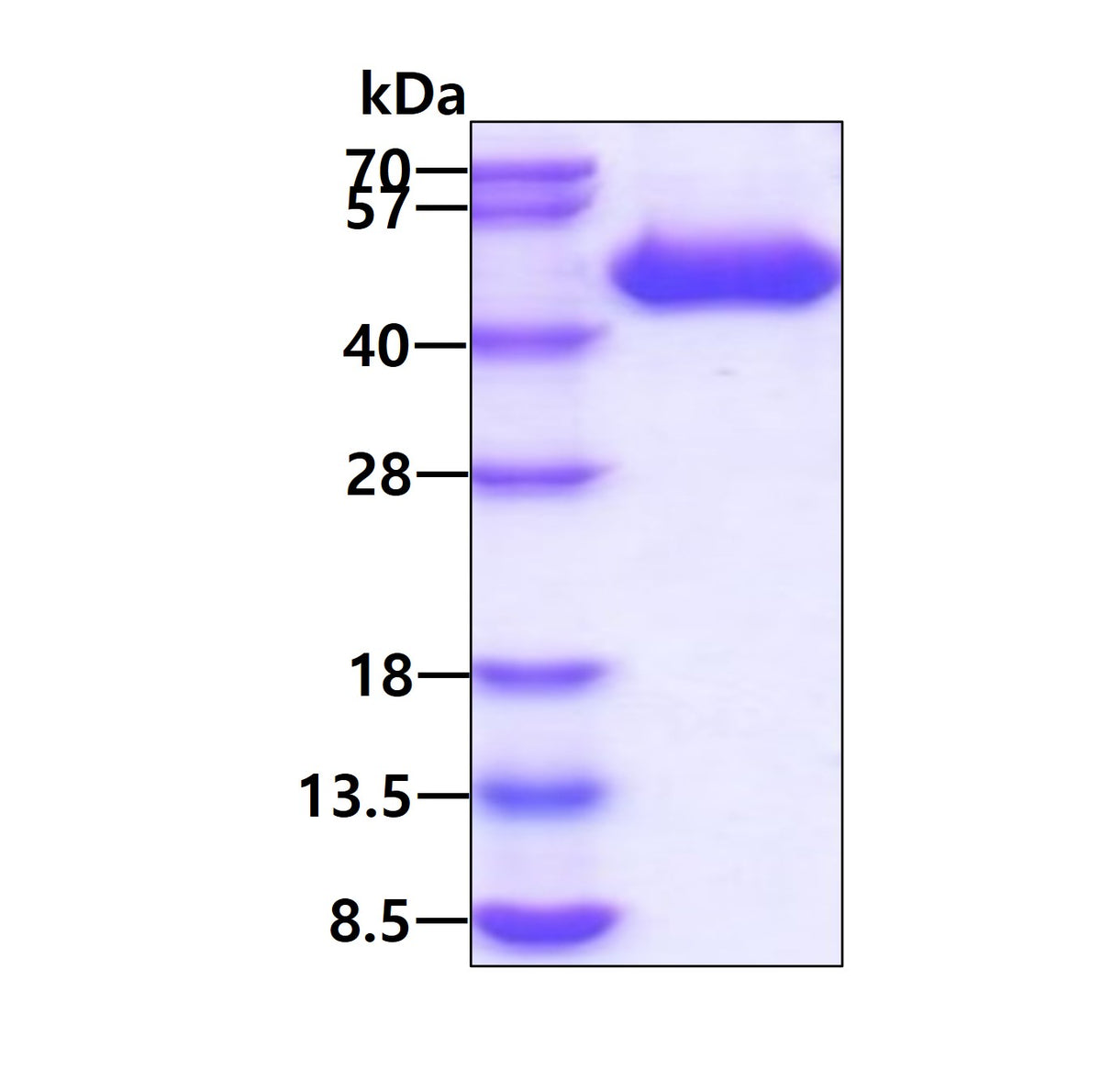 IL1RL1 Human, Sf9 Active - Product image 1