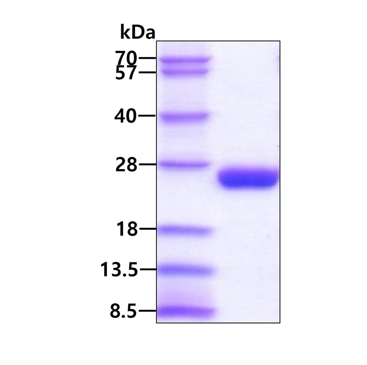 IL6 Human, His - Product image 1
