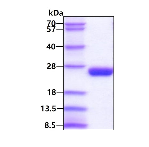 IL6 Human, His - Product image 1