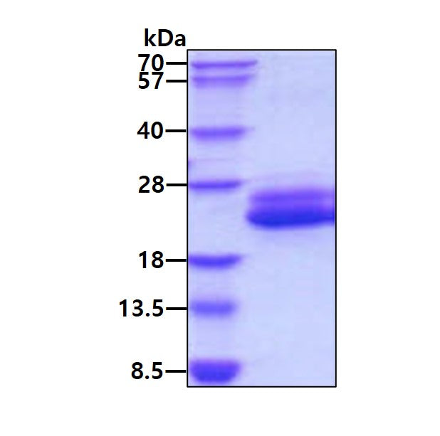 IL6 Human, Sf9 - Product image 1