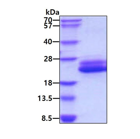 IL6 Human, Sf9 - Product image 1