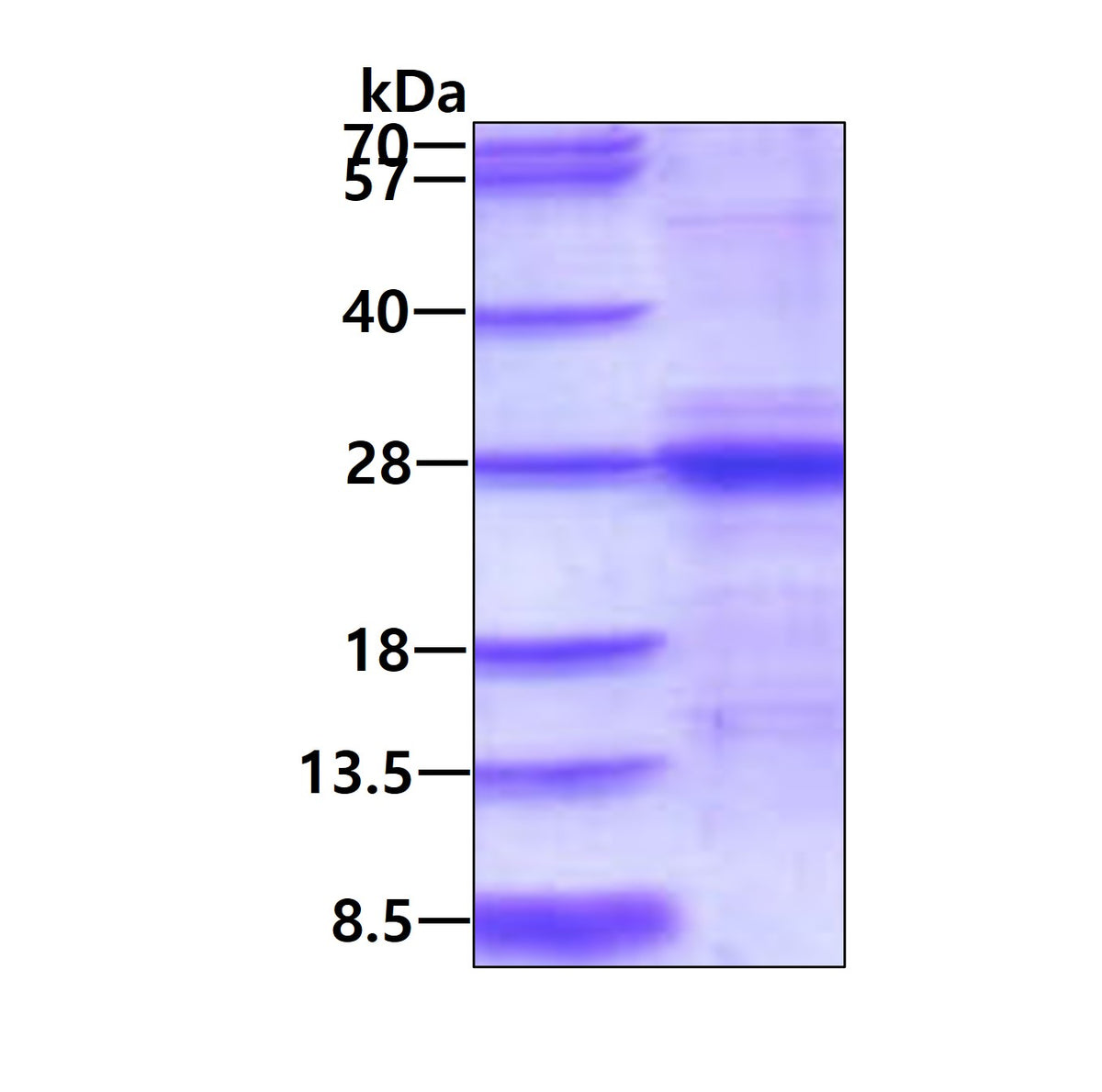 IL6 Mouse, His - Product image 1