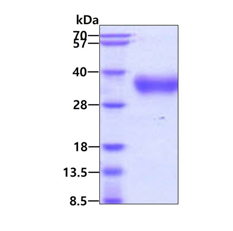 IL 4R Human - Product image 1