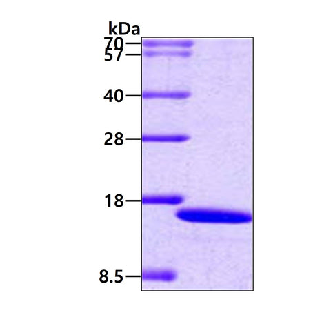 IRF2 Human - Product image 1