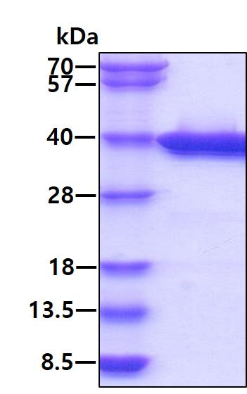 LGALS4 Human-SDS-PAGE - Product image 1