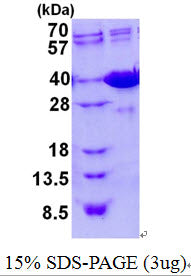 LGALS4 Mouse-SDS-PAGE - Product image 1