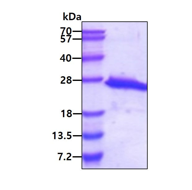 LGALS7 Human, His-SDS-PAGE - Product image 1