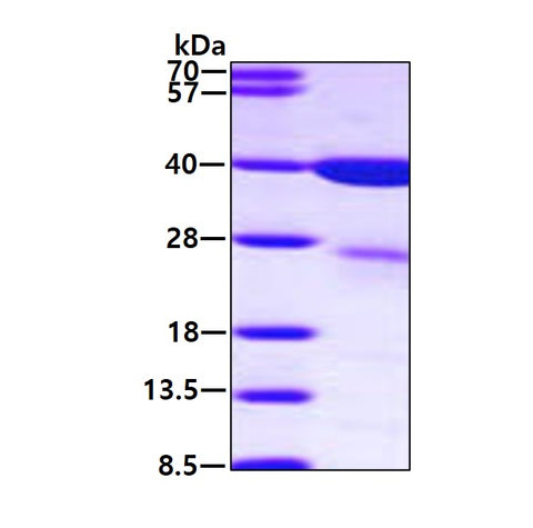 LGALS8 Human, His-SDS-PAGE - Product image 1