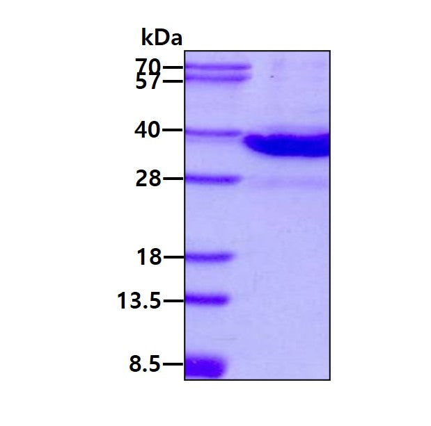 LGALS8 Mouse-SDS-PAGE - Product image 1
