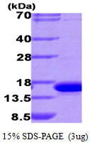 LGALS9 Human-SDS-PAG - Product image 1