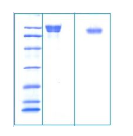 Tamm Horsfall-SDS-PAGE - Product image 1