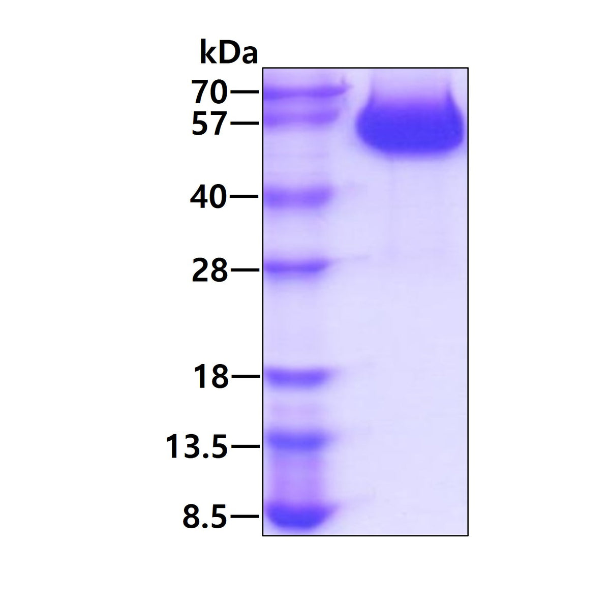 sIL6R Human, Sf9 - Product image 1