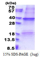 CD116 Human-sds-page - Product image 1