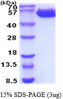 CD131 Human-sds-page - Product image 1