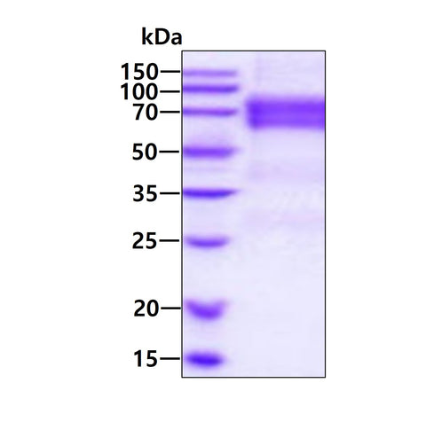 ANGPT2 Human - Product image 1