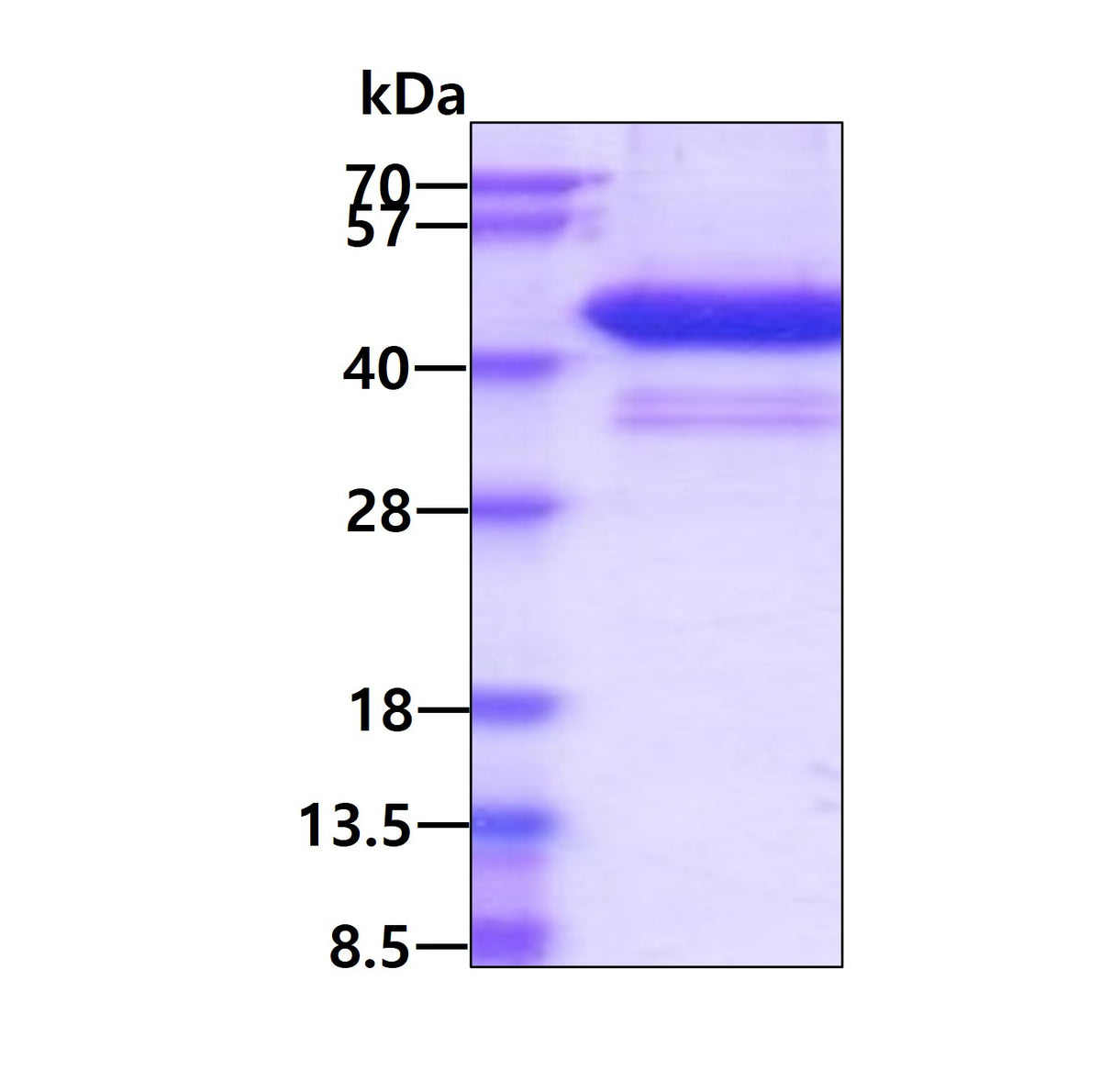 ACVR1 Human sds-page - Product image 1