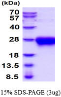 ACVR2A Human sds-page - Product image 1