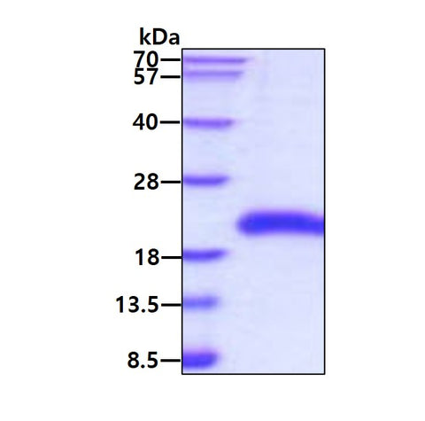 AITR-sds-page - Product image 1