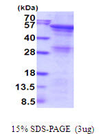 ANGPTL2-sds-page - Product image 1