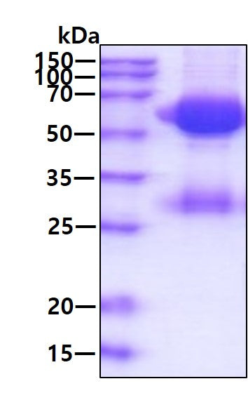 ANGPTL3-sds-page - Product image 1