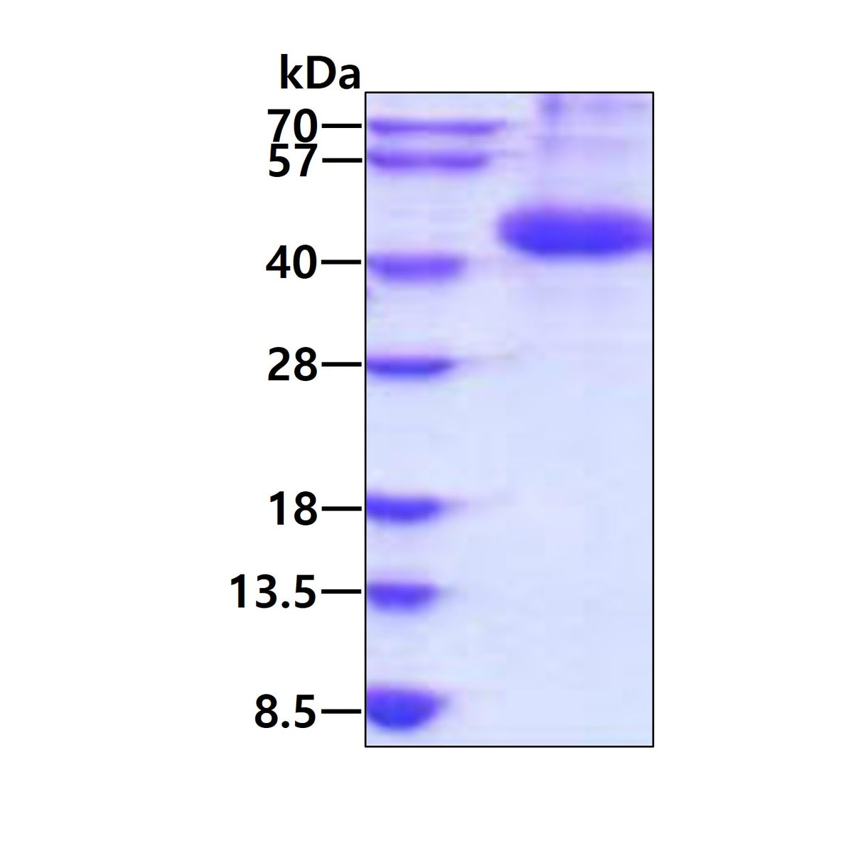 ANGPTL7-sds-page - Product image 1