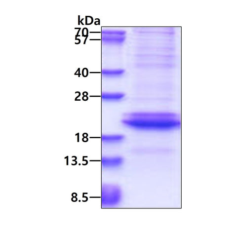 Adiponectin-sds-page - Product image 1