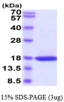 Adiponectin-sds-page - Product image 1