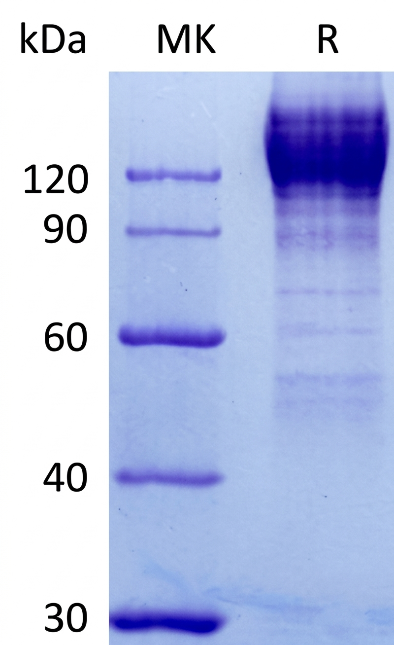 CEA Human sds-page - Product image 1