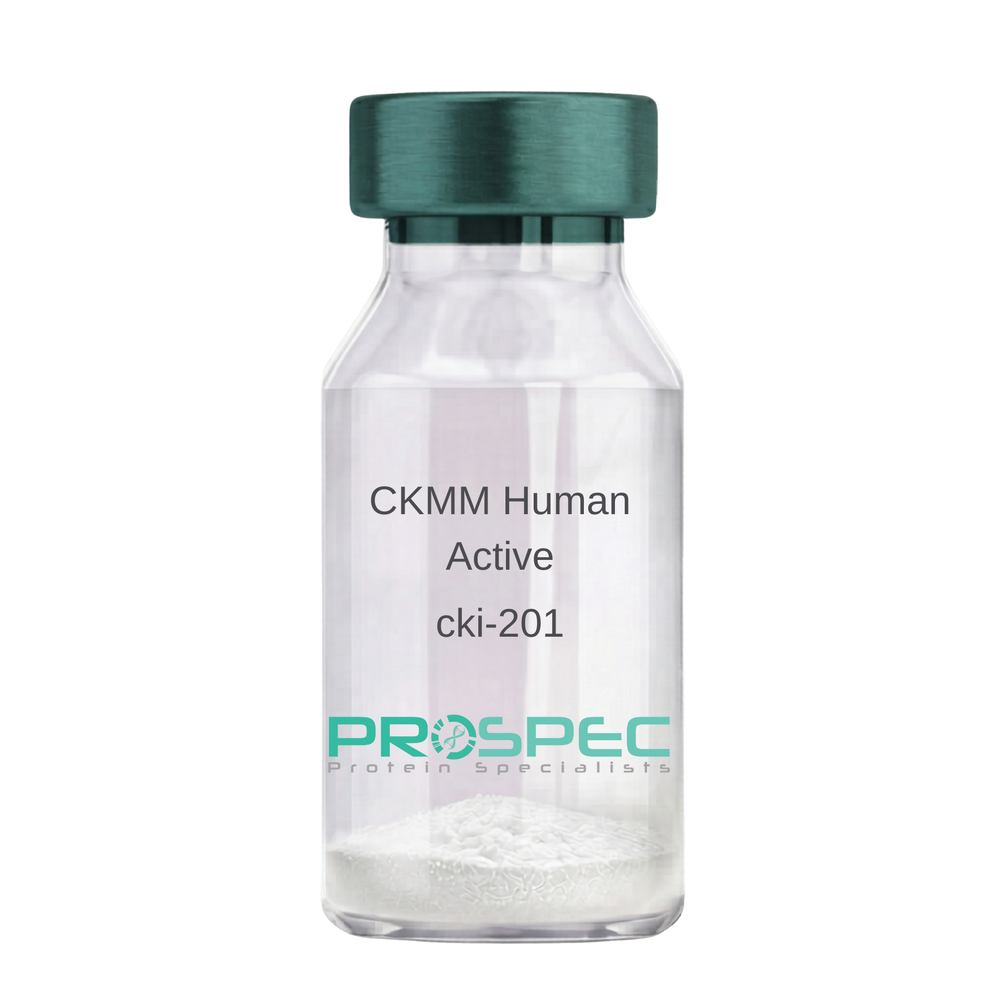 CKMM Human Active
